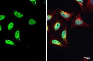 Anti-HYPB/SETD2 antibody used in Immunocytochemistry/ Immunofluorescence (ICC/IF). GTX127905