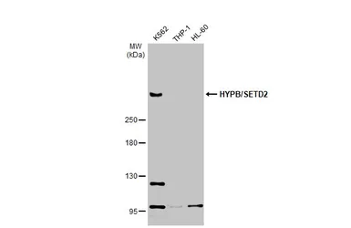 Anti-HYPB/SETD2 antibody used in Western Blot (WB). GTX127905