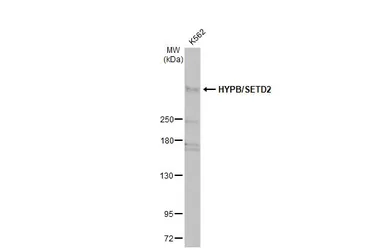 Anti-HYPB/SETD2 antibody used in Western Blot (WB). GTX127906