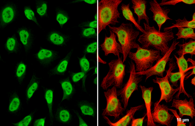 Anti-hnRNP A2B1 antibody used in Immunocytochemistry/ Immunofluorescence (ICC/IF). GTX127928
