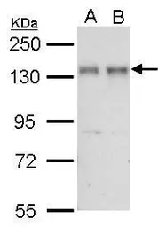 Anti-NFAT1 antibody used in Western Blot (WB). GTX127932