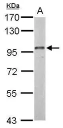 Anti-Dynamin 3 antibody used in Western Blot (WB). GTX127933