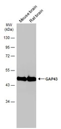 Anti-GAP43 antibody used in Western Blot (WB). GTX127937