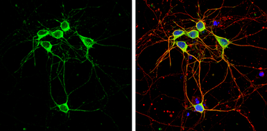 Anti-CaMKII alpha antibody used in Immunocytochemistry/ Immunofluorescence (ICC/IF). GTX127939
