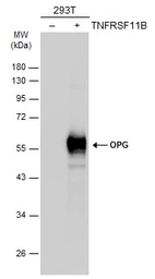 Anti-OPG antibody used in Western Blot (WB). GTX127948