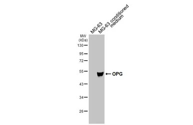 Anti-OPG antibody used in Western Blot (WB). GTX127948