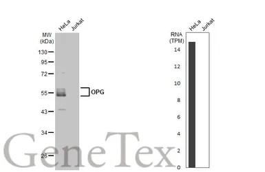 Anti-OPG antibody used in Western Blot (WB). GTX127948