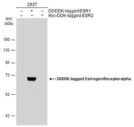 Anti-Estrogen Receptor alpha antibody used in Western Blot (WB). GTX127978
