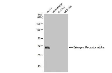 Anti-Estrogen Receptor alpha antibody used in Western Blot (WB). GTX127978