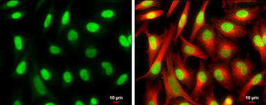 Anti-CFDP1 antibody used in Immunocytochemistry/ Immunofluorescence (ICC/IF). GTX128024