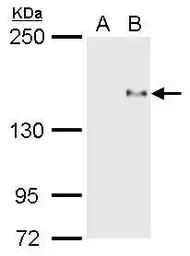 Anti-PREX1 antibody used in Western Blot (WB). GTX128035