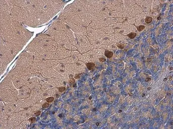 Anti-PSRC1 antibody used in IHC (Paraffin sections) (IHC-P). GTX128047
