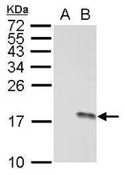 Anti-Histone H3S10ph (phospho Ser10) antibody used in Western Blot (WB). GTX128116