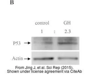 Anti-p53 antibody used in Western Blot (WB). GTX128135
