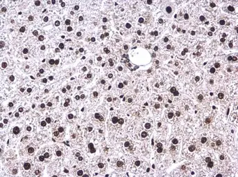 Anti-ATR (phospho Thr1989) antibody used in IHC (Paraffin sections) (IHC-P). GTX128145
