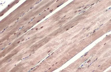 Anti-ATR (phospho Thr1989) antibody used in IHC (Paraffin sections) (IHC-P). GTX128145