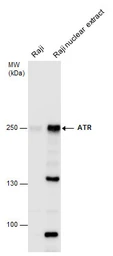 Anti-ATR antibody used in Western Blot (WB). GTX128146