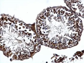Anti-ATR antibody used in IHC (Paraffin sections) (IHC-P). GTX128146