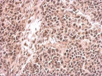 Anti-G9a antibody used in IHC (Paraffin sections) (IHC-P). GTX128164