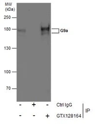 Anti-G9a antibody used in Immunoprecipitation (IP). GTX128164