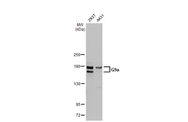 Anti-G9a antibody used in Western Blot (WB). GTX128164
