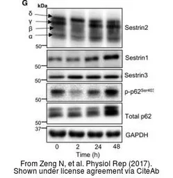 Anti-SQSTM1 / P62 (phospho Ser403) antibody used in Western Blot (WB). GTX128171