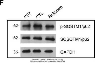 Anti-SQSTM1 / P62 (phospho Ser403) antibody used in Western Blot (WB). GTX128171