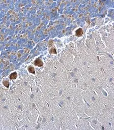 Anti-SQSTM1 / P62 (phospho Ser403) antibody used in IHC (Paraffin sections) (IHC-P). GTX128171