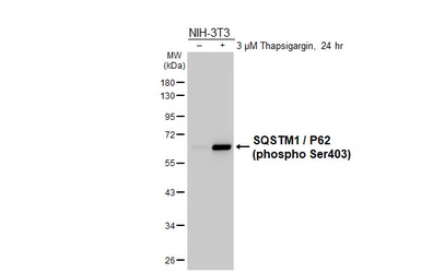 Anti-SQSTM1 / P62 (phospho Ser403) antibody used in Western Blot (WB). GTX128171