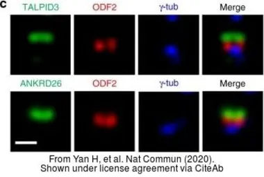 Anti-ANKRD26 antibody used in Immunocytochemistry/ Immunofluorescence (ICC/IF). GTX128255