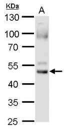 Anti-Foxa2 antibody used in Western Blot (WB). GTX128273