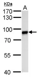 Anti-Vasa antibody used in Western Blot (WB). GTX128306