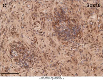 Anti-Sox10 antibody used in IHC (Paraffin sections) (IHC-P). GTX128374
