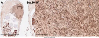 Anti-Sox10 antibody used in IHC (Paraffin sections) (IHC-P). GTX128374