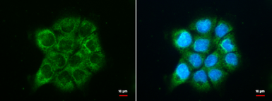 Anti-ATG9A antibody used in Immunocytochemistry/ Immunofluorescence (ICC/IF). GTX128427