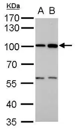 Anti-ATG9A antibody used in Western Blot (WB). GTX128427