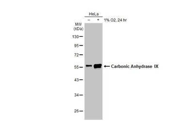 Anti-Carbonic Anhydrase IX antibody used in Western Blot (WB). GTX128428