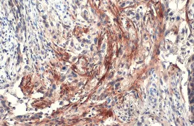 Anti-Carbonic Anhydrase IX antibody used in IHC (Paraffin sections) (IHC-P). GTX128428