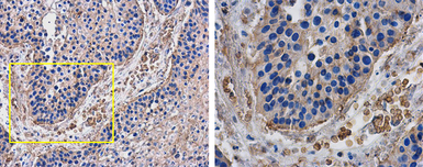 Anti-PD1 antibody used in IHC (Paraffin sections) (IHC-P). GTX128435