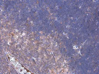 Anti-PD1 antibody used in IHC (Paraffin sections) (IHC-P). GTX128435