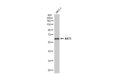 Anti-AKT1 antibody used in Western Blot (WB). GTX128456