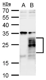 Anti-FGF18 antibody used in Western Blot (WB). GTX128496
