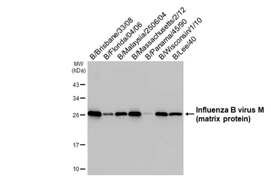 Anti-Influenza B virus M (matrix protein) antibody used in Western Blot (WB). GTX128536
