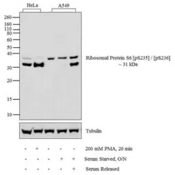 Anti-RPS6 (phospho Ser235/236) antibody used in Western Blot (WB). GTX12864
