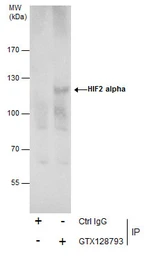 Anti-HIF2 alpha antibody used in Immunoprecipitation (IP). GTX128793