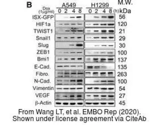 Anti-SLUG antibody used in Western Blot (WB). GTX128796