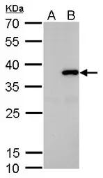 Anti-SLUG antibody used in Western Blot (WB). GTX128796