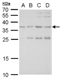 Anti-SLUG antibody used in Western Blot (WB). GTX128796