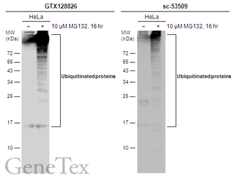 Anti-Ubiquitin antibody used in Western Blot (WB). GTX128826