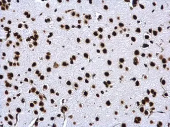 Anti-Histone H3K18ac (Acetyl Lys18) antibody used in IHC (Paraffin sections) (IHC-P). GTX128943